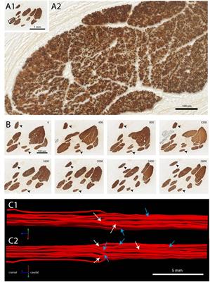 Sympathetic components in left and right human cervical vagus nerve: implications for vagus nerve stimulation